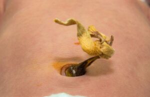 What Happens If You Don’t Cut The Umbilical Cord What Happens If You Don’t Cut The Umbilical Cord