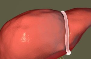 What Happens if Gallbladder Stones Are Not Removed What Happens if Gallbladder Stones Are Not Removed