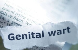 What Happens if Genital Warts Go Untreated? What Happens if Genital Warts Go Untreated?