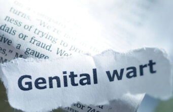 What Happens if Genital Warts Go Untreated? What Happens if Genital Warts Go Untreated?