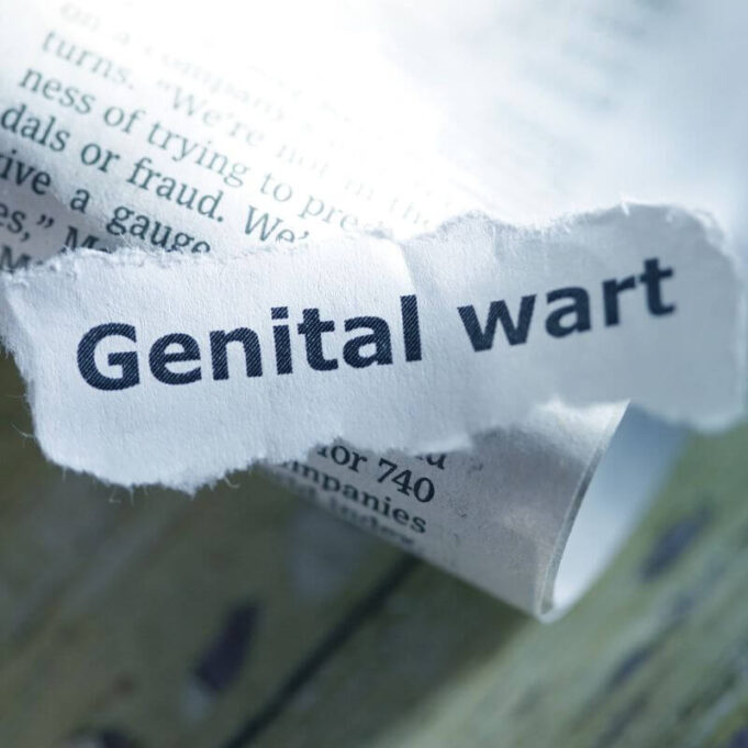 What Happens if Genital Warts Go Untreated? What Happens if Genital Warts Go Untreated?