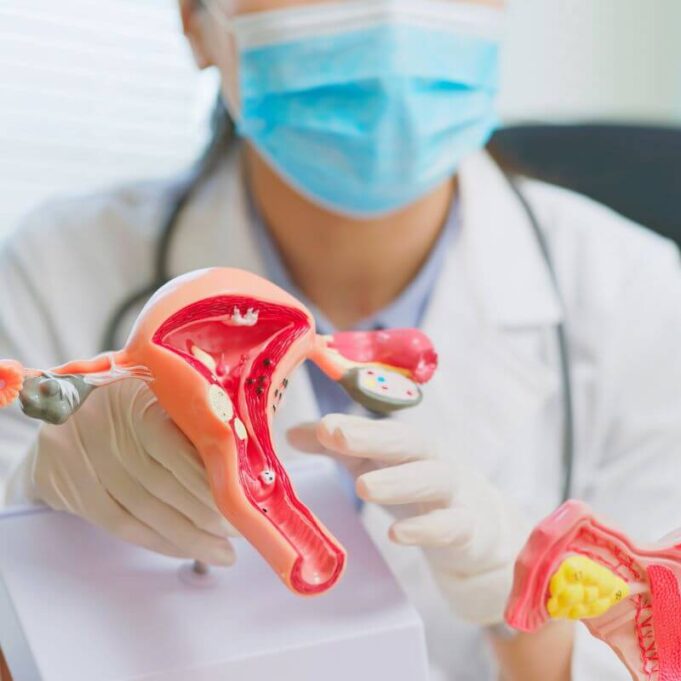 What Happens if PCOS is Not Treated What Happens if PCOS is Not Treated
