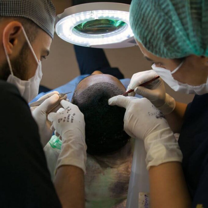 How Much is Hair Transplant in Nigeria How Much is Hair Transplant in Nigeria