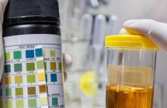 Why Is My Urine Dark Yellow Why Is My Urine Dark Yellow