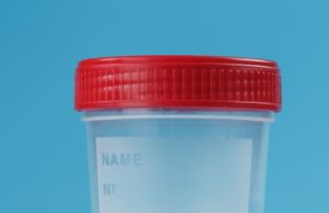 Can Watery Sperm Get a Woman Pregnant Can Watery Sperm Get a Woman Pregnant