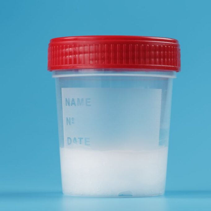 Can Watery Sperm Get a Woman Pregnant Can Watery Sperm Get a Woman Pregnant