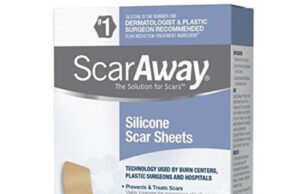 Accident Scar Removal Cream on Face, Price, and Where to Buy Accident Scar Removal Cream on Face, Price, and Where to Buy