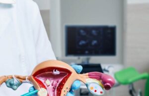 Can I Shrink My Fibroids Naturally? Can I Shrink My Fibroids Naturally?
