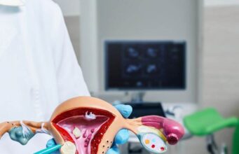 Can I Shrink My Fibroids Naturally? Can I Shrink My Fibroids Naturally?