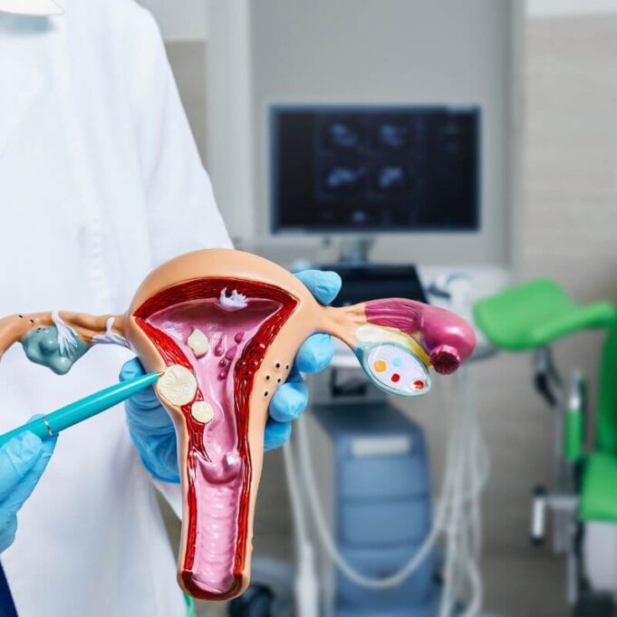 Can I Shrink My Fibroids Naturally? Can I Shrink My Fibroids Naturally?