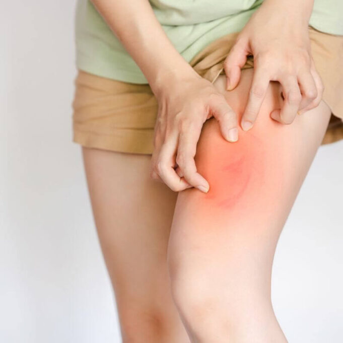 Home Remedies for Itching in Private Parts Female Home Remedies for Itching in Private Parts Female