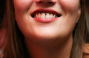How Long Does Smiley Piercing Take to Heal How Long Does Smiley Piercing Take to Heal
