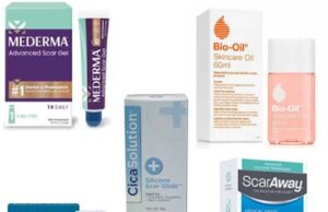 List of Working Scar Removal Cream, Prices, and Where to Buy List of Working Scar Removal Cream, Prices, and Where to Buy
