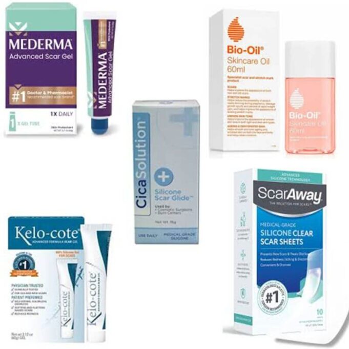 List of Working Scar Removal Cream, Prices, and Where to Buy List of Working Scar Removal Cream, Prices, and Where to Buy