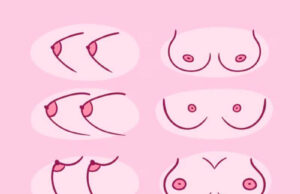 My Nipples Are Flat Unless I Am Cold. Meaning and What to Do My Nipples Are Flat Unless I Am Cold. Meaning and What to Do