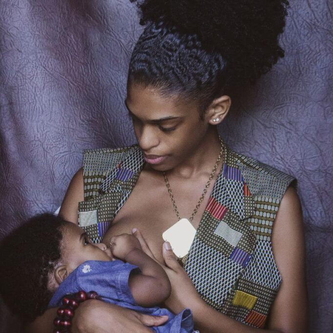Nipple Falling Off After Breastfeeding. What Must I Do? Nipple Falling Off After Breastfeeding. What Must I Do?