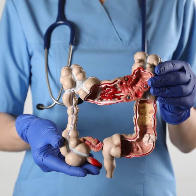 Benefits of Colon Cleansing on the Skin Benefits of Colon Cleansing on the Skin